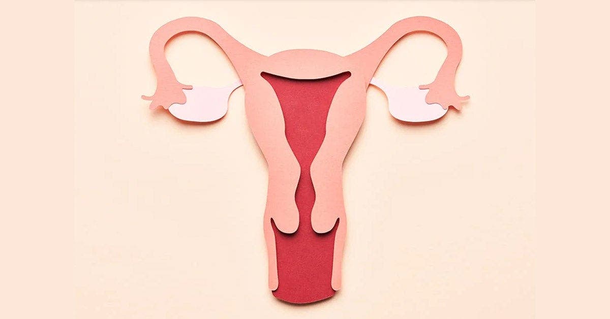 Que sont les fibromes utérins? Voici tout ce que vous devez savoir