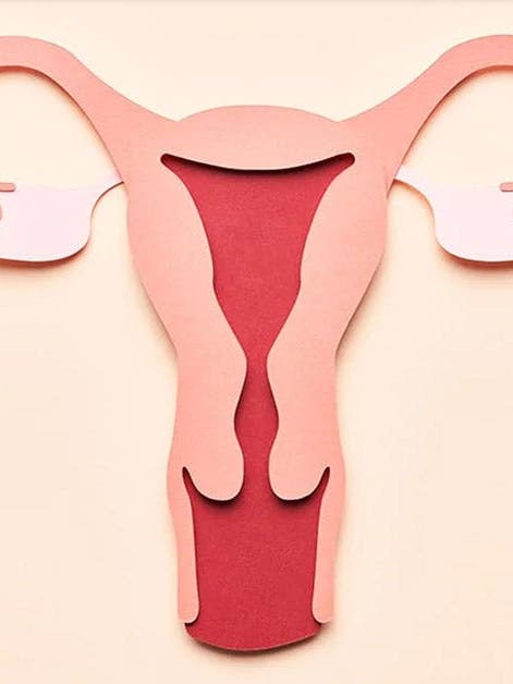 Que sont les fibromes utérins? Voici tout ce que vous devez savoir