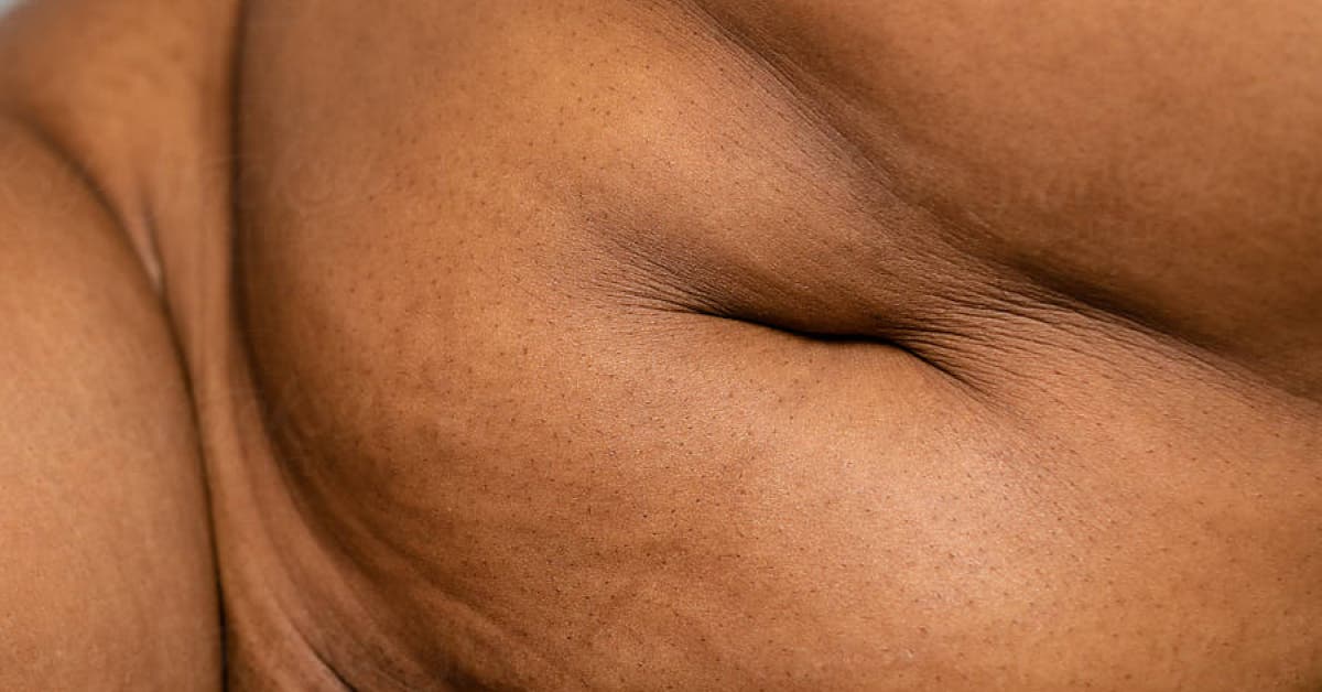 What is menopause belly?