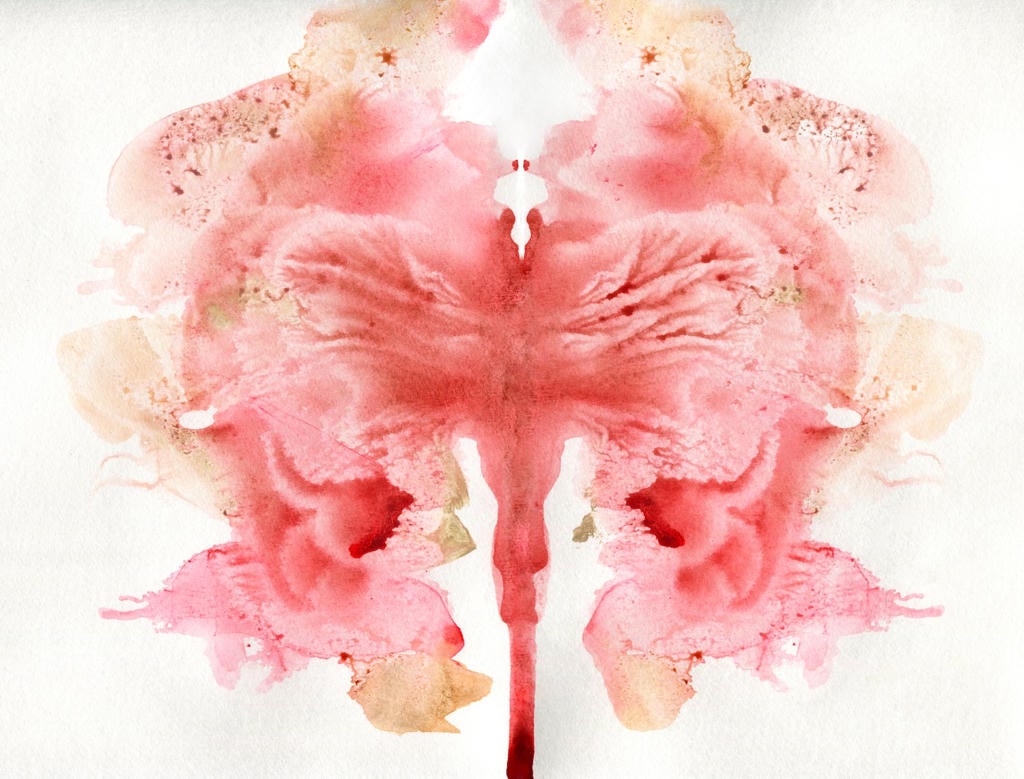 I wanted to fix my painful periods—I didn’t know I’d be ending them for good